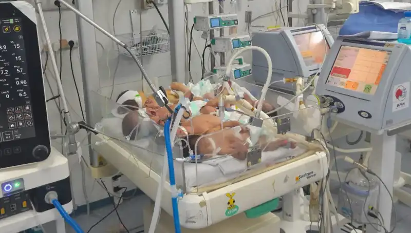 Gazzeli Doktorlar, Kuvöz Sorunu ile Çaresizlik İçinde Mücadele Ediyor