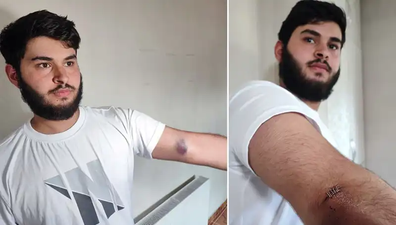 Bahçeye Kaçan Top Mahallede Büyük Kargaşaya Neden Oldu