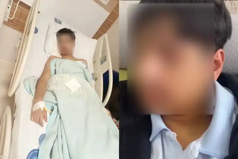 Antalya'da Akran Zorbalığı: Sınıf Arkadaşının Çenesini Kırdı!