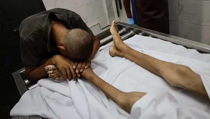 Gazze’de Açlık Sınırında Çocuk Hayatını Kaybetti: Acı Gerçekler