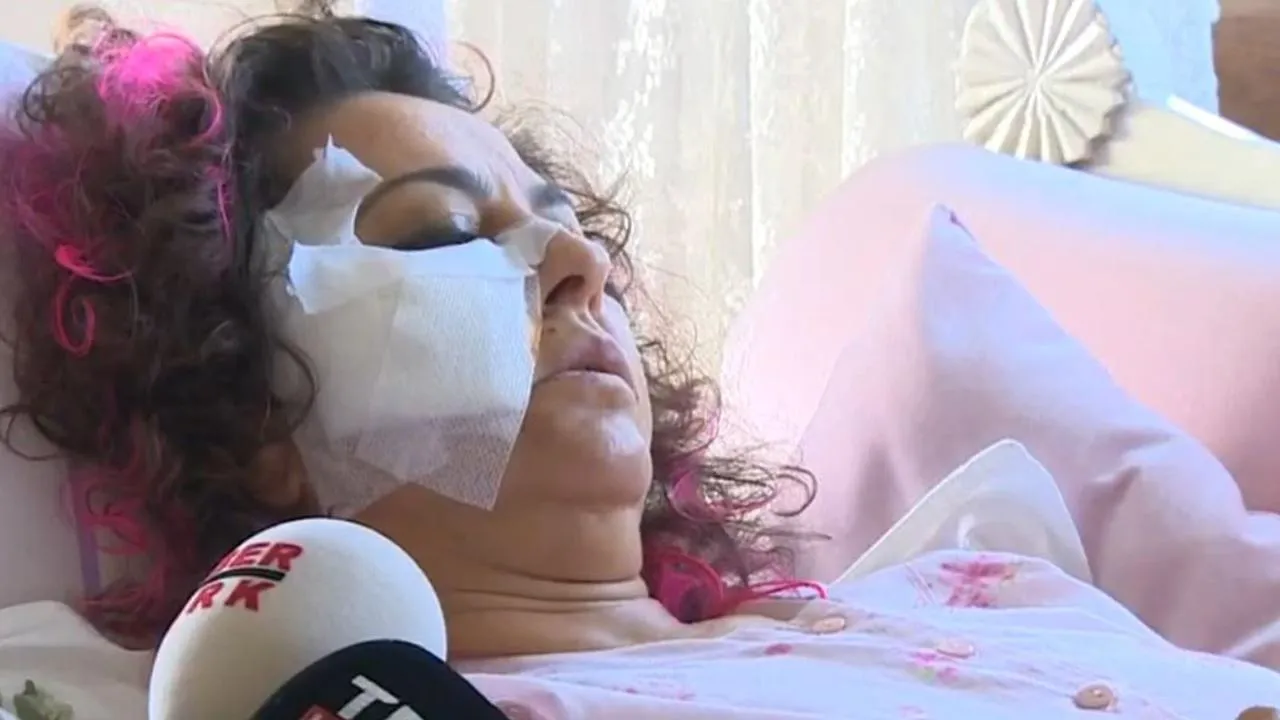 Başıboş Köpeklerin Saldırısına Uğrayan Akademisyen: "Bu Artık İnsan Hakları Sorunu"