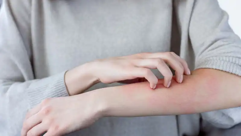 Cilt Kanserinin Gizli Belirtileri: Dermatologdan Şaşırtan İpuçları